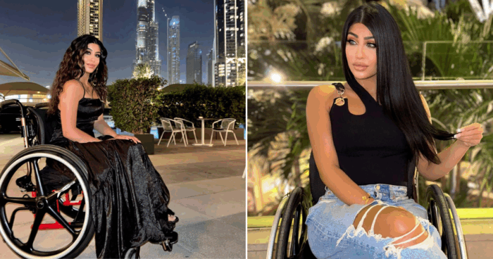 Social Media Erupts As A Lebanese-American Paraplegic Influencer Walks Again!