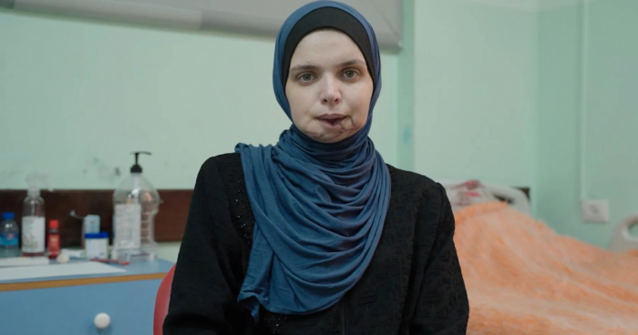 Injured Journalist Duha Al-Saify Vows To Keep Reporting After Losing 3 Children In Gaza